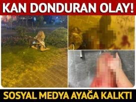 Antalya’da pitbull dehşeti!